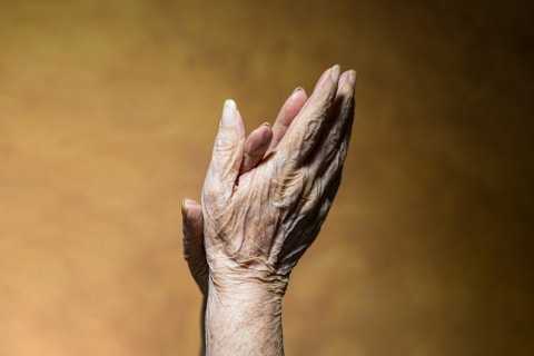 crepey skin on hands crepey skin on hands